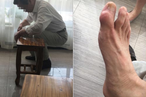 痛风久治不愈深受痛苦折磨 痛风久治不愈深受痛苦折磨 慕名来到我院治疗摆脱病痛
