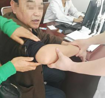 6年痛风患者病情严重接受正规治疗终 6年痛风患者病情严重接受正规治疗终