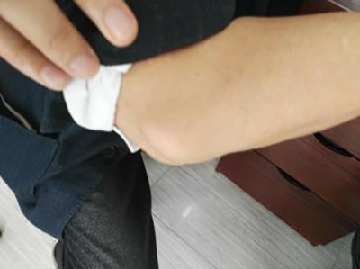 痛风反复发作治疗无效 科学技术帮助铲除危害 痛风反复发作治疗无效 科学技术帮助铲除危害